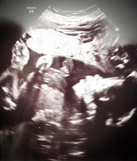 Mini-me, pregnant, ultrasound