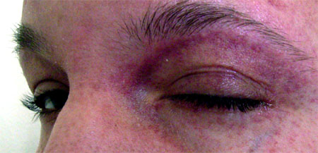 augen
