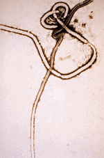 Ebola_virus_em