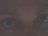 300-Augen-Anabells