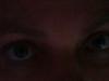 300-dunklere-Augen-Anabells