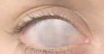 jekylla_auge