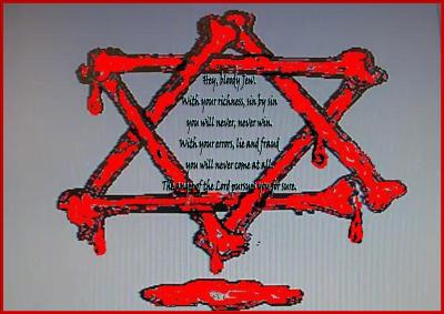 BLOODY-STAR-ISRAEL-how-do-you-do-B-1viner-hand-a-shadow-white