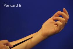 Pericard-6