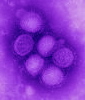 H1N1_influenza_virus_small