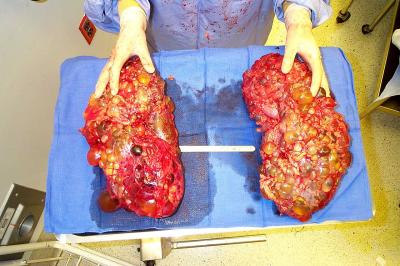 dads_kidneys