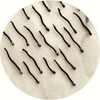 sperm1