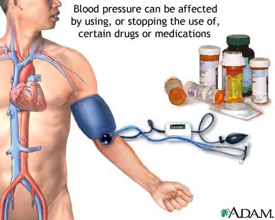 hilfe-von-hypertension