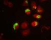 intrazelluläre mikroorganismen (chlamydien grün fluoreszierend, menschliche zellen rot fluoreszierend)