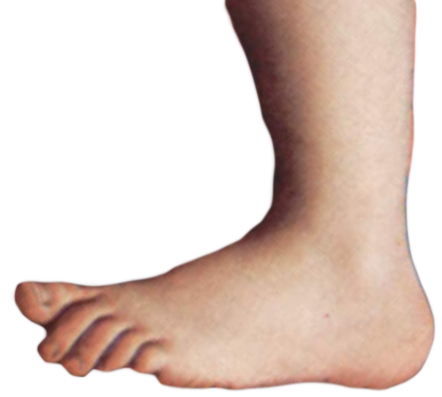 Monty_python_foot