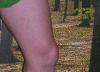 Knie