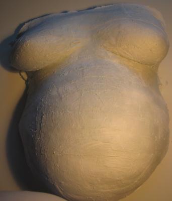 gipsbauch_2