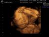 BABYFOTO_16
