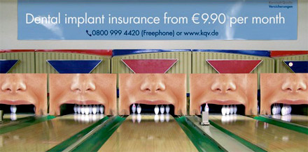 dental_implants