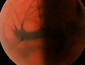 mars