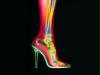 high20heel20xray