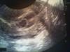 baby-008